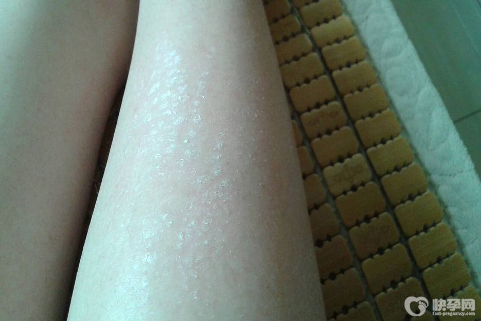 腿上长了许多小白点怎么回事？以下3个均为常见诱因