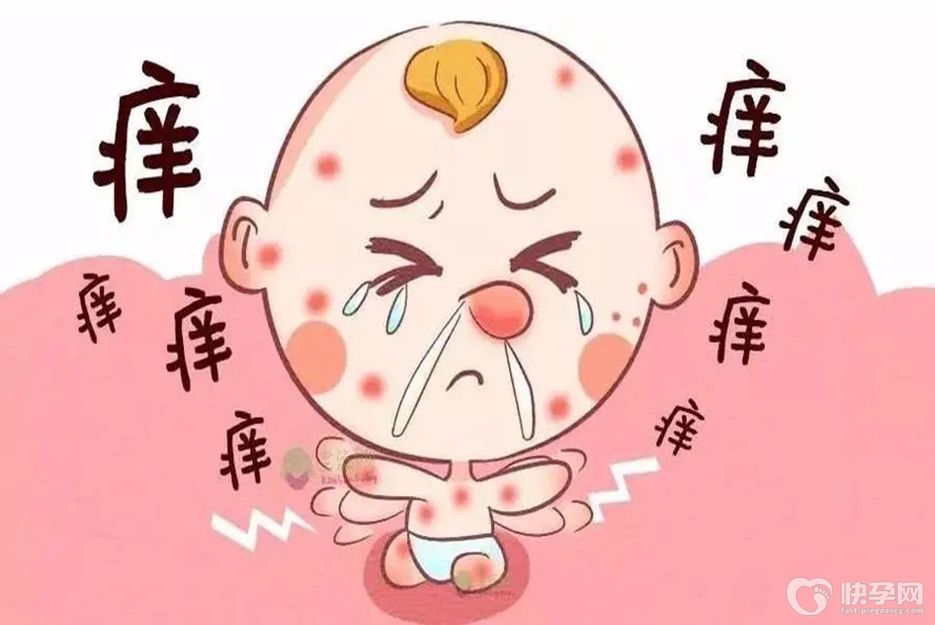 过敏反应的四种类型，谨记对症下药才有效