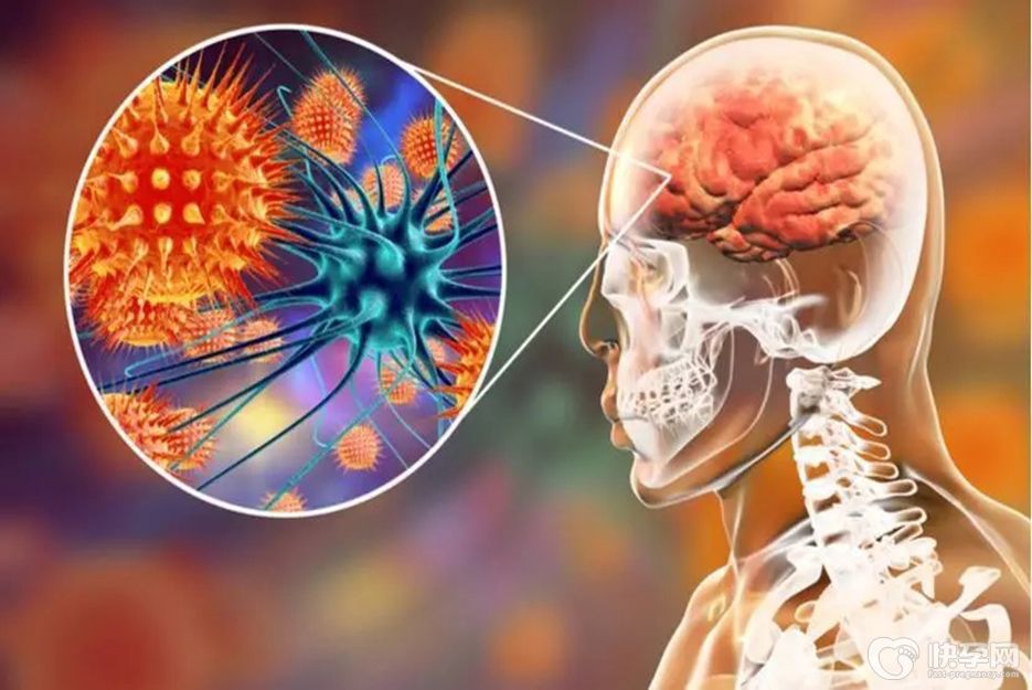 大脑炎的症状有哪些？出现这6个表现记心上