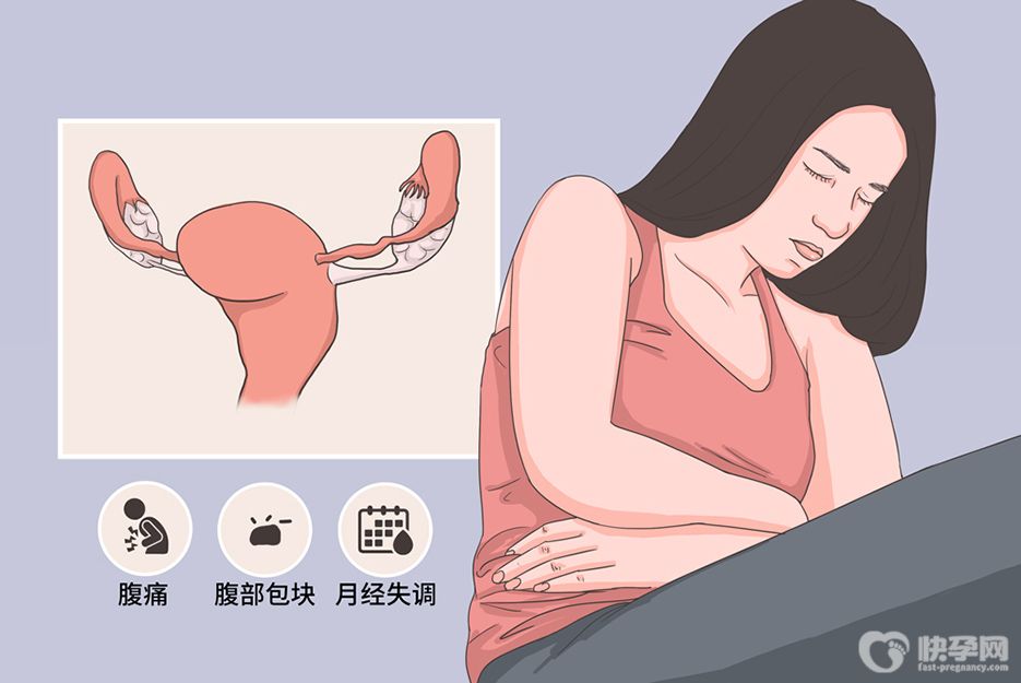 女性卵巢畸胎瘤严重吗？先别紧张，文章说的很明白