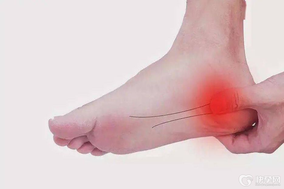 筋膜炎的6大表现症状，教你快速认识筋膜炎