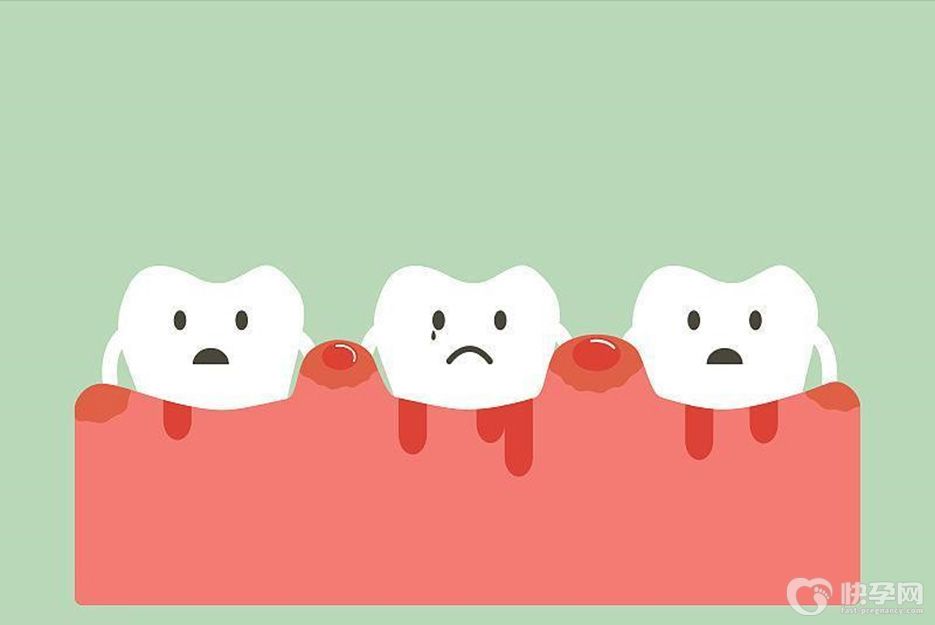 牙龈癌的早期三大症状，若你全没有，请继续保持