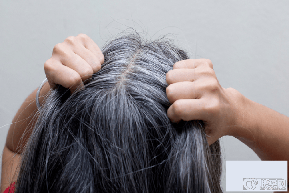 三个部位长白发最危险，分别是后脑勺、两鬓、前额