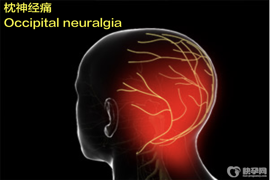 枕大神经痛的症状有哪些？浅析枕大神经痛的3大表现