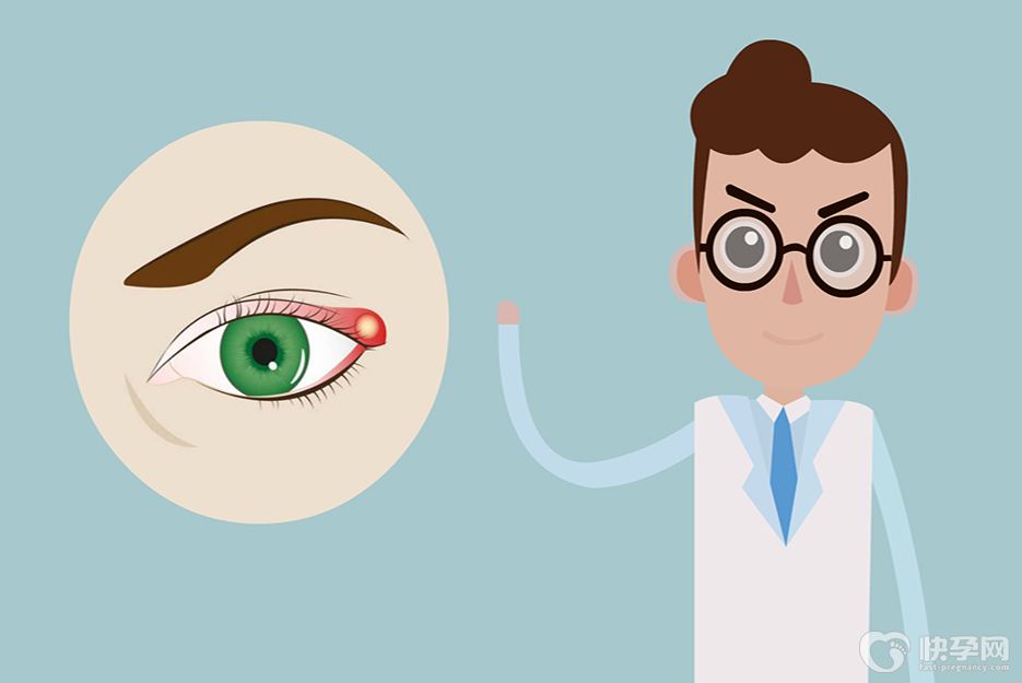 眼睛长了个麦粒肿怎么消除？3种方式来给眼睛做大扫除