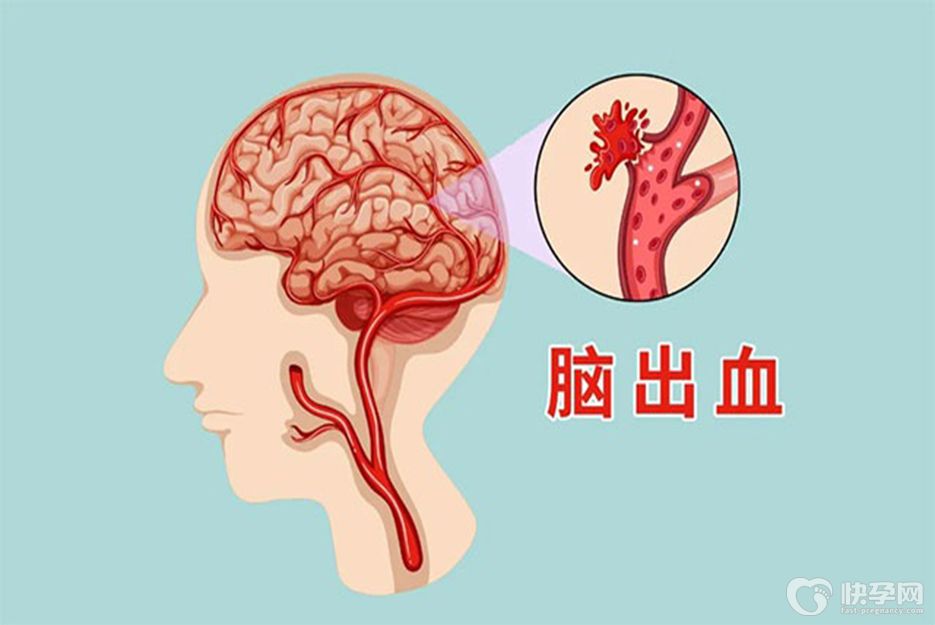 女性舌头发麻应警惕的病，医生直言：多是这4种情况导致