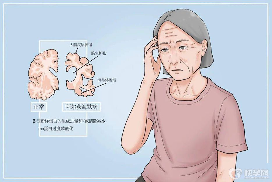 盘点老年痴呆最初表现，老年朋友需要多留意