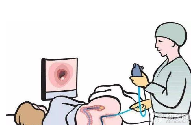 6种症状需做肠镜检查，肠镜对肠癌到底有多大的作用