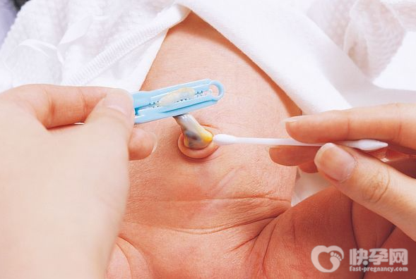 新生儿肚脐怎样护理?新生儿肚脐护理的8个要点要记牢