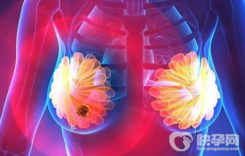 乳腺结节怎么饮食调理，少吃发物有助于散结