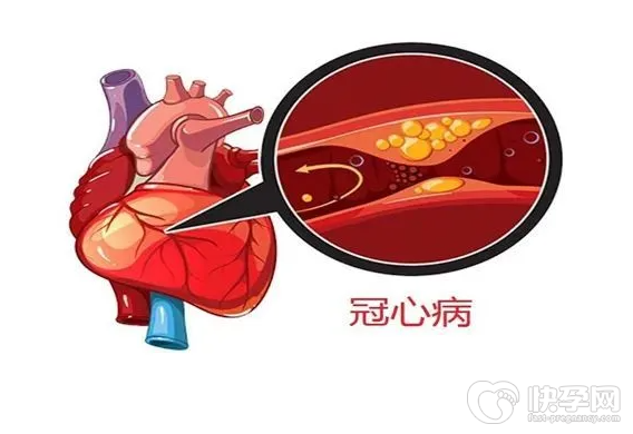 冠心病的症状表现在哪些方面？冠心病要如何调理改善？