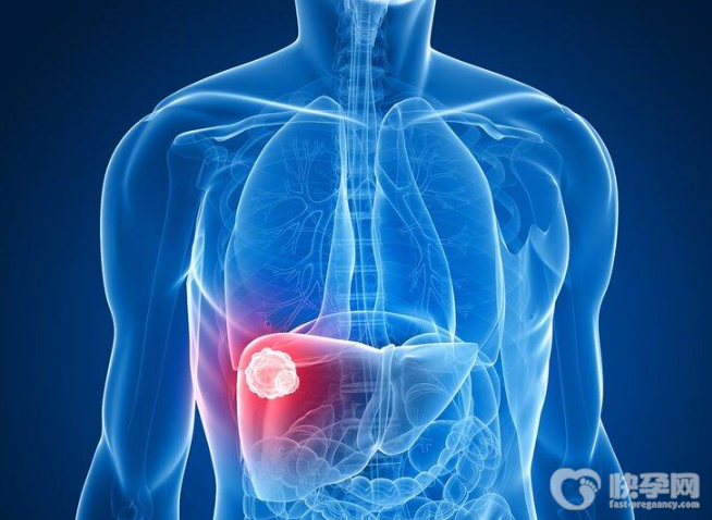 女性肝癌早期七个症状，希望你一个也没有