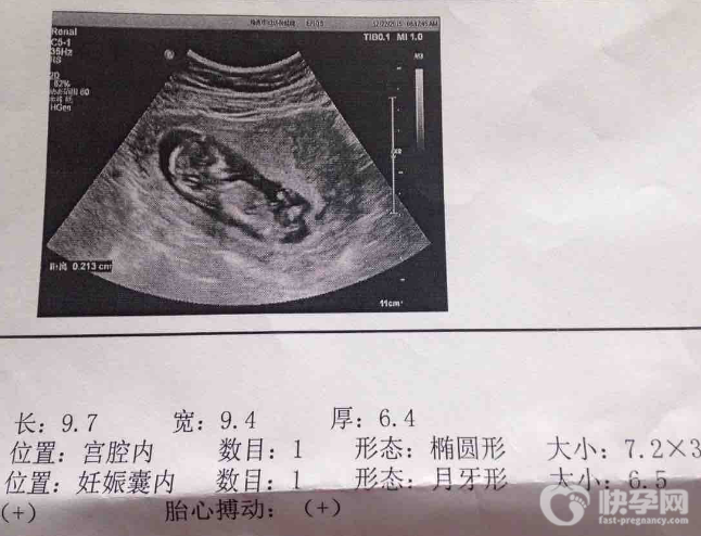 医生说做了nt就不用做唐筛了,真相出乎你的意料