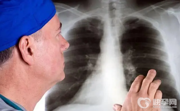 肺癌早期有三处痛，出现一个就要马上去医院