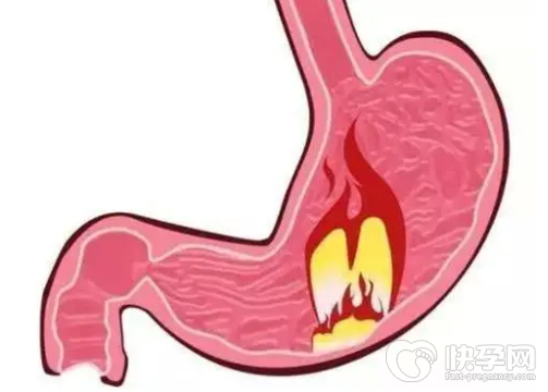 姜缩性胃炎的症状有哪些？姜缩性胃炎要如何预防？