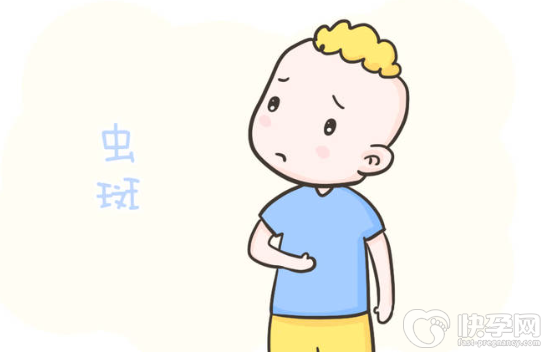 怎么判断人体是否该驱虫了？常见驱虫药有哪些？