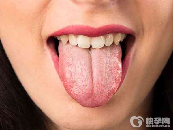 舌苔白又厚口干口苦是怎么回事？要如何调理改善？