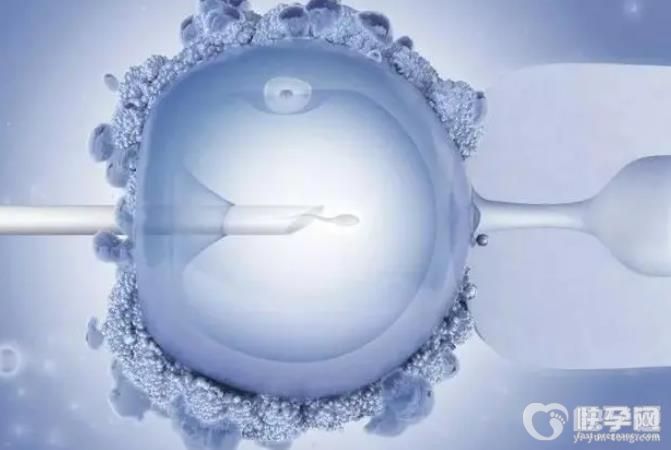 产假包含双休日和法定假日吗？如何优化产假政策？