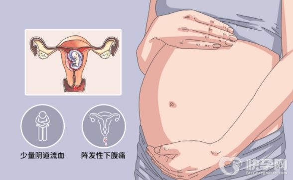 关于先兆流产,你们是否遇到过这样的问题？
