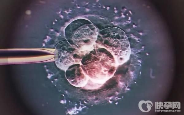 试管婴儿移植后对睡姿有要求吗？试管移植后尿频正常吗？