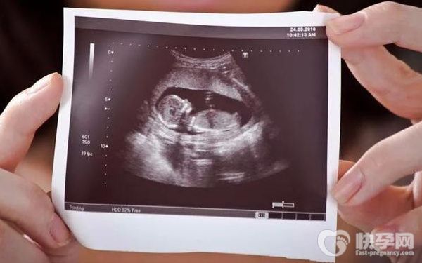 生育险男女报销都一样吗？生育保险报销需要哪些材料？