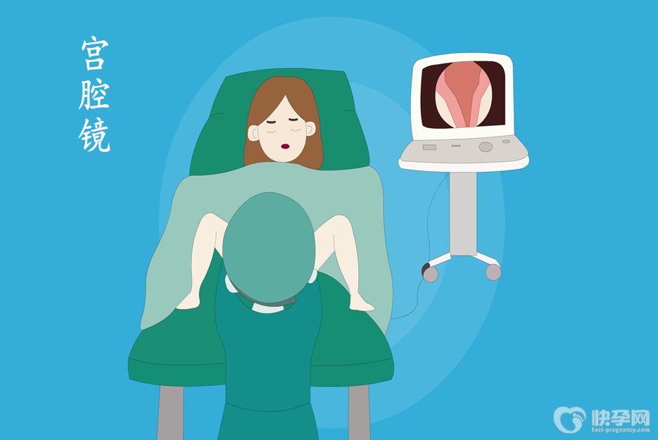 宫腔镜主要是检查什么内容，7种情况8个事项都要了解