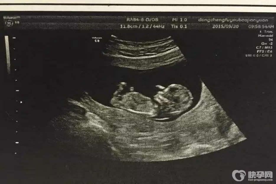 b超对胎儿有影响吗-明白这两点让你远离b超误区
