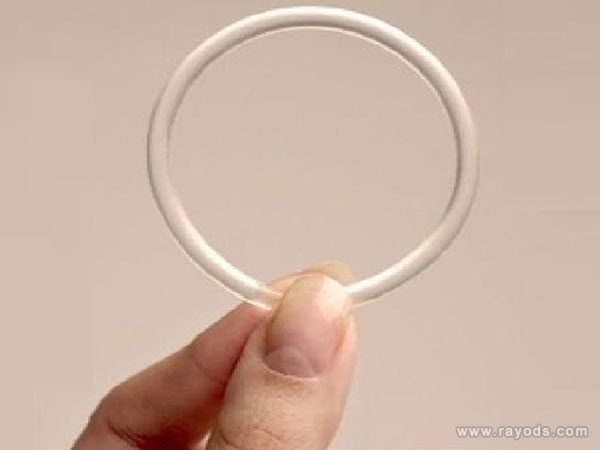 节育环有几种类型-环有哪些种类