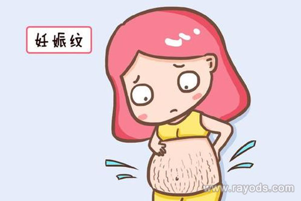 妊娠纹去不掉吗？如何预防妊娠纹的出现？