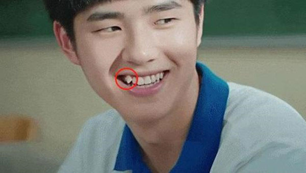 孩子的虎牙要不要拔掉 孩子矫正牙齿的最佳年级