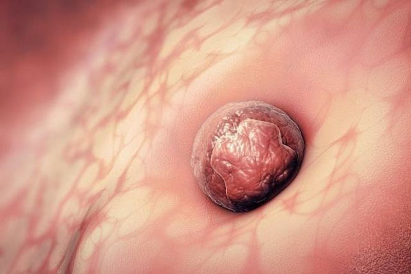 着床早晚跟男女有没有关系?看看下文就知道了