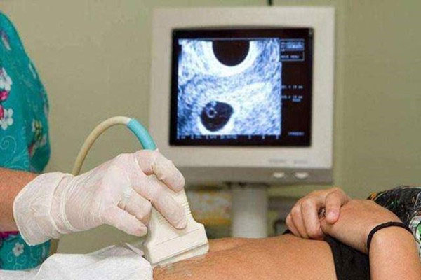 怎样区分怀宝宝是男孩还是女孩？孕初期一招看男女