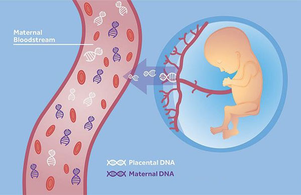 什么是血性羊水？孕妇血性羊水的危害