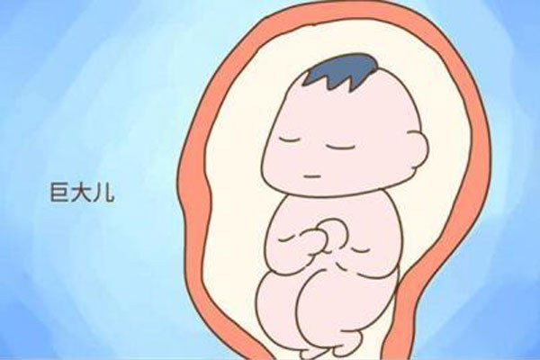 巨大儿是指体重多少？巨大儿双顶径标准多少
