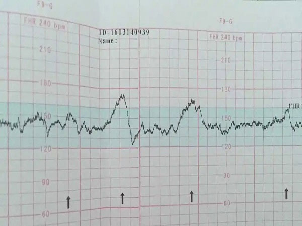 男女宝宝胎心率对照表分享，大于150一定是女孩待商榷