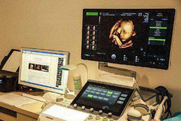 彩超看男孩女孩诀窍（孕12周nt暗示男女）