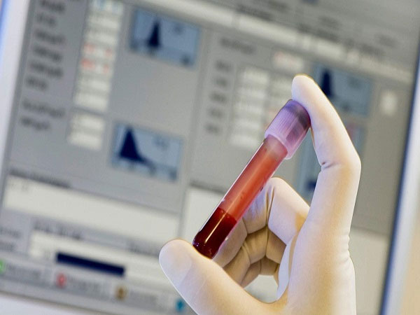 各地脐带血保存费用标准一览，一年多少钱看这里就知道