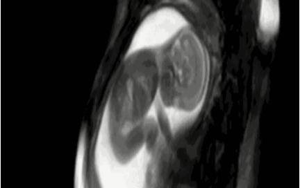 怀孕几个月有胎动，孕晚期为何夜间频繁感觉到胎动？