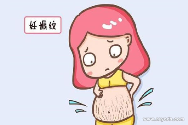妊娠纹是什么样的?初期妊娠纹长什么样