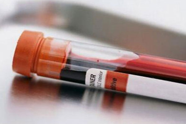 唐氏筛查结果判断 唐氏筛查afp是什么意思