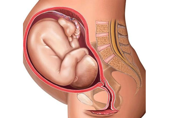 什么是胎位loa？胎位loa是男孩还是女孩