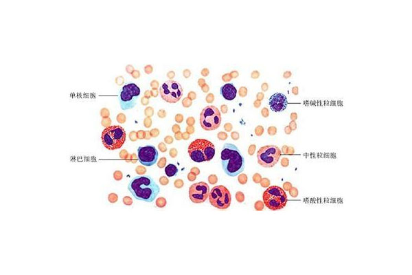 白细胞含量低怎么办 白细胞减少怎么回事