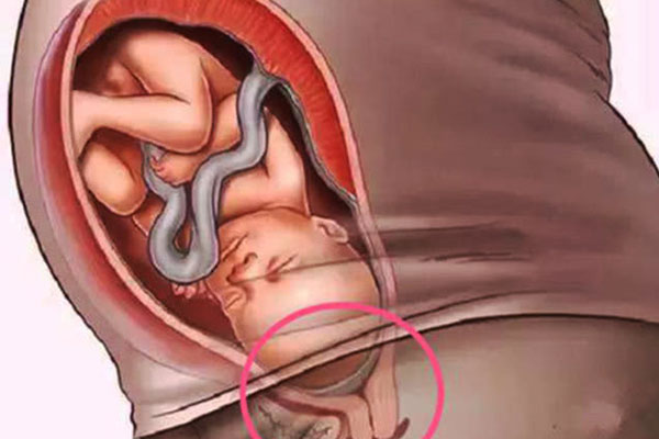 胎儿入盆的感觉和症状？胎儿入盆女性会有以下6种感觉