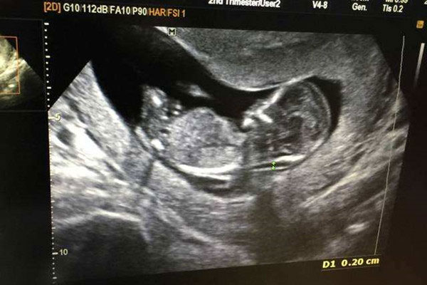 nub点和腿的区别 最大的不同点就是这个