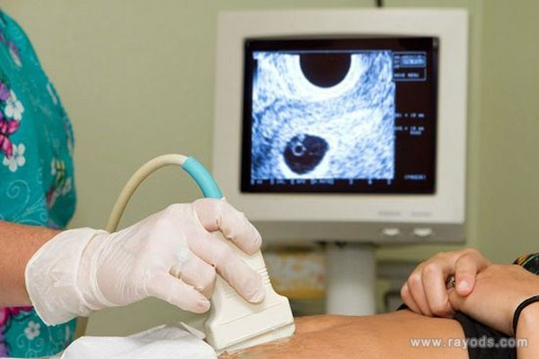 卵黄囊形成到胎芽出现时间早了解早放心