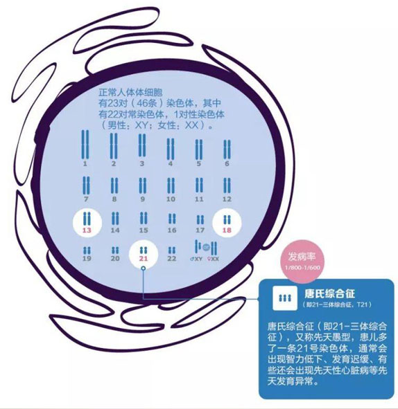 唐氏筛查结果怎么看男孩女孩？