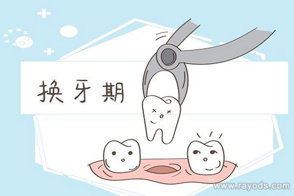 儿童什么时候换牙？儿童换牙多久长出来？