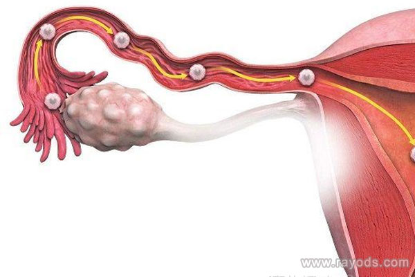 输卵管狭窄能否怀孕?输卵管狭窄的危害
