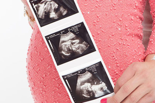 孕妈妈做四维彩超有什么用？盘点孕妇做四维彩超的4大好处！