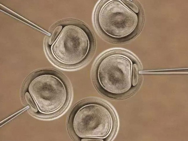 高龄试管卵泡少怎么办？总结几条妙招希望帮助到大家